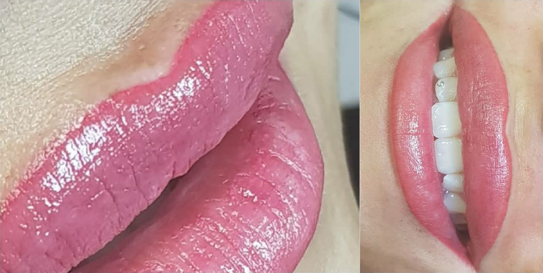 ICOLOR FIX Color Fixer Post Post procedura - immagine 5