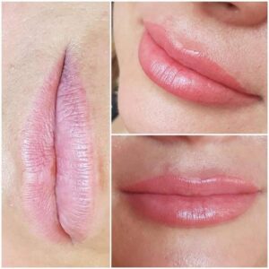 trattamento colortune 4 trattamento colortune 4