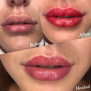 trattamento colortune 7 trattamento colortune 7