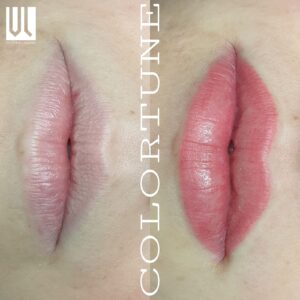 trattamento colortune 8 trattamento colortune 8