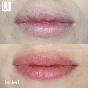 trattamento colortune 9 trattamento colortune 9