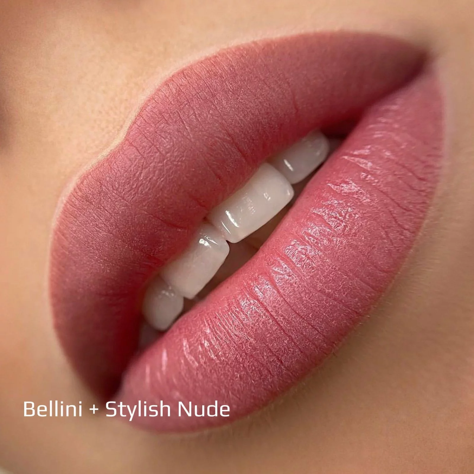 Line 2022 Set - immagine 8