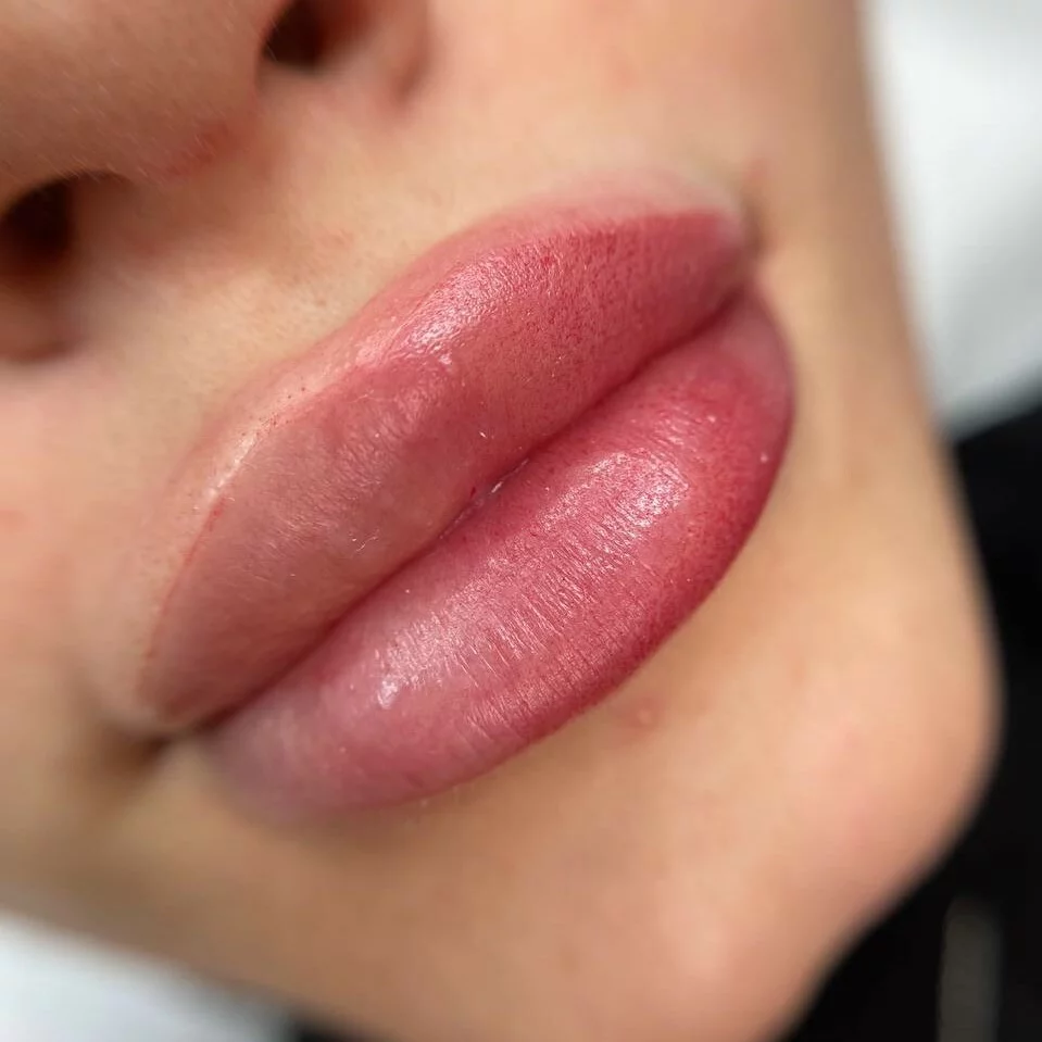 Line 2022 Set - immagine 3