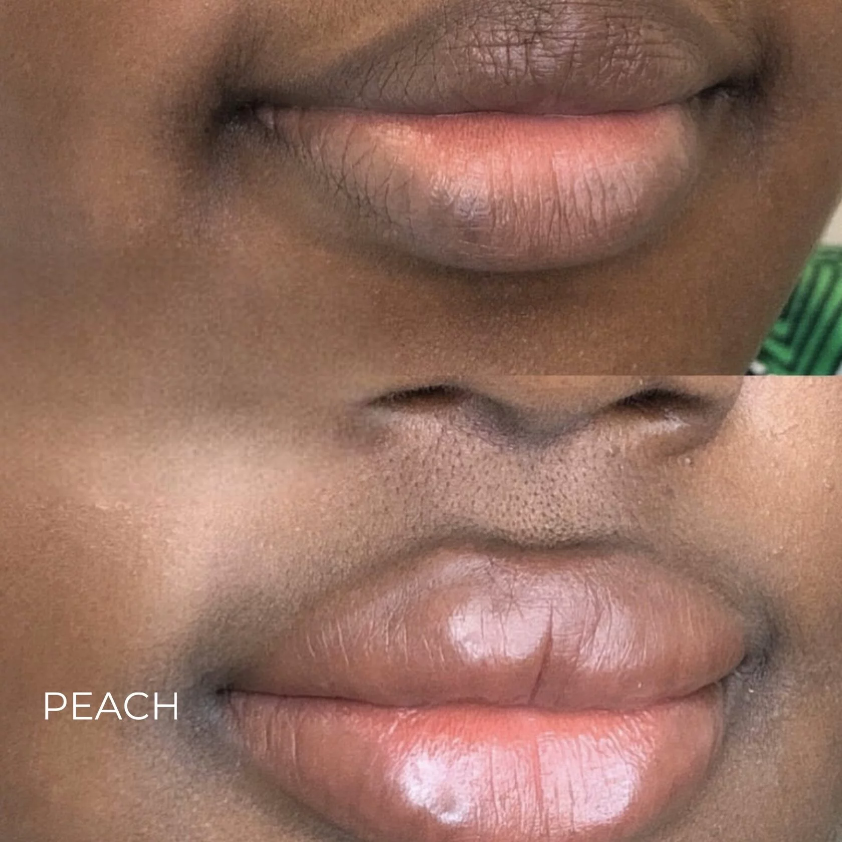 Set correttore - immagine 6