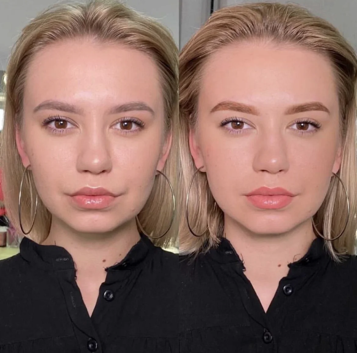 Set correttore - immagine 4