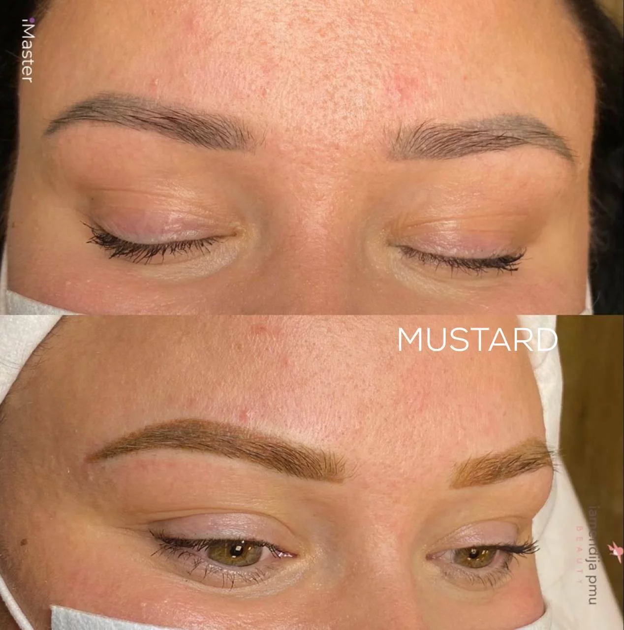 Set correttore - immagine 5